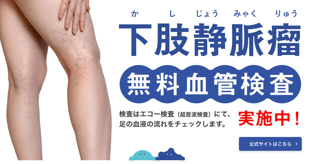 あなたの足は大丈夫？下肢静脈瘤かも？